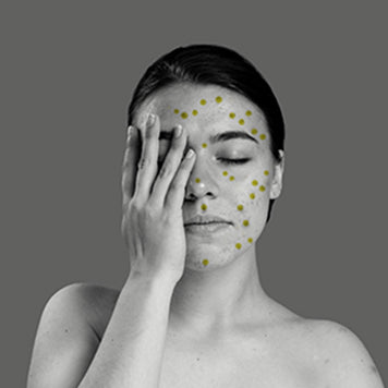 What Does Niacinamide Do for Your Skin?