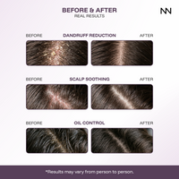 CINCINNUS Red Algae Extract Anti Dandruff Shampoo
