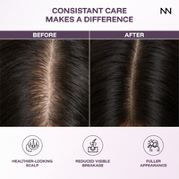 CINCINNUS Ginger Anti Hair Loss & Strengthening Shampoo
