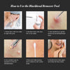 Majestique Blackheads Removing Needle Tool 2 In 1 1 Piece