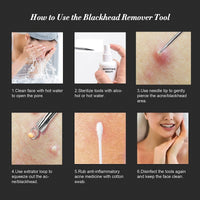 Majestique Blackheads Removing Needle Tool 2 In 1 1 Piece