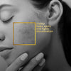 VLCC Clinic ProPerfect Spot Clarifying Face Wash