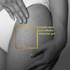 VLCC Clinic Anti-Stretch Mark Cream 100 ml