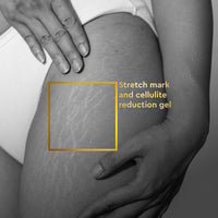 VLCC Clinic Anti-Stretch Mark Cream 100 ml