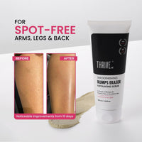 ThriveCo Bump Eraser Exfoliating Scrub 100 ml