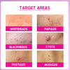 CosIQ ABP 11% Beginner Friendly Exfoliating Peel AHA 6% | PHA 4% | BHA 1% Peeling Solution, 30ml (Pack of 2)