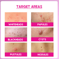CosIQ ABP 33% Strong Exfoliating Peel AHA 25% | PHA 6% | BHA 2% Peeling Solution, 30ml (Pack of 2)
