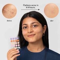 Gush Beauty Dart It Colourful Flower Hydrocolloid Pimple Patches 1 Piece