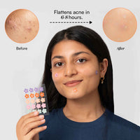 Gush Beauty Dart It Pink Flower Hydrocolloid Pimple Patches 1 Piece