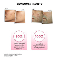 ThriveCo Goodbye Acne Kit 130 ml