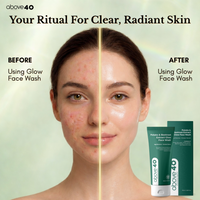 Above 40 Glow Face Wash – Korean Anti Ageing & Brightening Cleanser with Glutathione 100 ml
