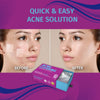 BonAiyu Health Acne Pimple Patch Removable Strips/Stickers For Men And Women With Salicylic Acid 24 Patches