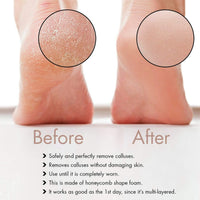 Majestique Dual Side Foot Filer Assorted 1 Piece