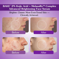BAKE 2% Kojic Acid Face Serum with MelasaRx™ Complex for Dark Spots, Pigmentation & Brightening Glow -30ml - 4