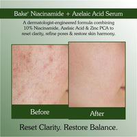 BAKE 10% Niacinamide +Azelaic Acid + 2% Kojic Acid Serum: Fades Acne Marks, Spots & Open Pores-30ml - 4