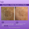 BAKE Spot Erase™ Dark Spot Correcting Serum Cream with Kojic Acid for Post Acne Marks, Melasma & Pigmentation-30g - 4