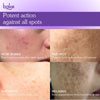 BAKE Spot Erase™ Dark Spot Correcting Serum Cream with Kojic Acid for Post Acne Marks, Melasma & Pigmentation-30g - 7