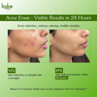 BAKE 2% Salicylic Acid Acne Spot Serum Gel -Overnight Acne Corrector for Pimples, Breakouts, Redness & Clogged Pores-30g - 5