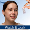 BAKE 2% Salicylic Acid Hydrocolloid Surface XL Acne Patches for Active Blemishes, Blackheads & Whiteheads, Pore Care - 9