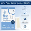 BAKE 2% Salicylic Acid Hydrocolloid Surface XL Acne Patches for Active Blemishes, Blackheads & Whiteheads, Pore Care - 13