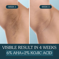 BAKE 6% AHA Underarm Brightening Roll-On Serum with 2% Kojic Acid & 3% Niacinamide – For Underarm Brightening & Exfoliation-50ml - 6