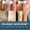 BAKE 2% Kojic Acid Scrub Soap for Pigmentation, Dark Spots & Tan Removal with Alpha Arbutin & MelasaRx-Pack of 1 100g - 3