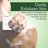 BAKE 2% Salicylic Acid Soap with Niacinamide for Body & Back Acne, Reduces Strawberry Legs & Fades Dark Spots - Pack of 3 100g x 3 - 5
