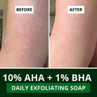 BAKE 10% AHA + 1% BHA Scrub Treatment Soap with Lactic Acid For Clogged Pores, Exfoliation, Strawberry Skin & Bright Underarms - Pack of 3 100g x 3 - 4