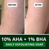 BAKE 10% AHA + 1% BHA Scrub Treatment Soap with Lactic Acid For Clogged Pores, Exfoliation, Strawberry Skin & Bright Underarms - Pack of 3 100g x 3 - 4