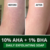 BAKE 10% AHA + 1% BHA Scrub Treatment Soap with Lactic Acid For Clogged Pores, Exfoliation, Strawberry Skin & Bright Underarms - Pack of 4 100g × 4 - 6