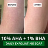 BAKE 10% AHA + 1% BHA Scrub Treatment Soap with Lactic Acid For Clogged Pores, Exfoliation, Strawberry Skin & Bright Underarms - Pack of 4 100g × 4 - 6