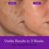 BAKE Night Peel RX Overnight Peel-Off Mask with Kojic Acid and Turmeric for Pigmentation, Tan, Dark Spots - 100ml - 7
