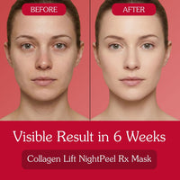BAKE Collagen Night Peel Rx with 2% Soluble Collagen Mask for Firming, Tightening, Elasticity & Hydration - 100 ml - 6