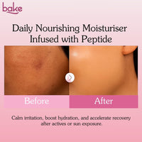 BAKE Daily Nourishing Ceramide Face Moisturizer with Peptides for Post-Acne Marks & Scars| 72H Hydration - 100g - 4
