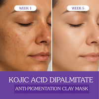 BAKE 2% Kojic Acid Dipalmitate Anti-Pigmentation Clay Mask for Dark Spots, Tan & Uneven Skin Tone- 100g - 7