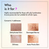 By NAKED fact Detoxifying Anti Acne Face Wash for Men & women | 100 ml