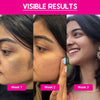CosIQ ABP 11% Beginner Friendly Exfoliating Peel AHA 6% | PHA 4% | BHA 1% Peeling Solution - 30 ml