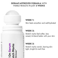 CosIQ Stretch Marks Removal Roll-On Serum with Striover, Scar Removal, Uneven Skin Tone, All Skin Types, 40ml