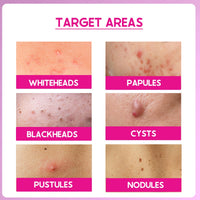 CosIQ ABP 22% Regular Use Exfoliating Peel AHA 15% | PHA 5% | BHA 2% Peeling Solution, 30ml (Pack of 2)