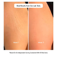 Cos-IQ Stretch Marks Removal Roll-On Serum (Pack of 3 X 40ml Each), with Striover, Scar Removal, Uneven Skin Tone, All Skin Types, 120ml