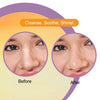 DR.Rashel Vitamin C Nose Strips with Witch Hazel Extracts 10 Strips & 10 Wipes - 35 gm