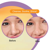 DR.Rashel Vitamin C Nose Strips with Witch Hazel Extracts 10 Strips & 10 Wipes - 35 gm