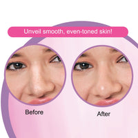 DR.Rashel White Skin Nose Pore Strips|10 Strips & 10 Wipes 35 gm