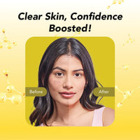 DR.RASHEL Bio Collagen Deep Facial Mask with Salicylic Acid – Acne Control & Pore Purifying Sheet Mask