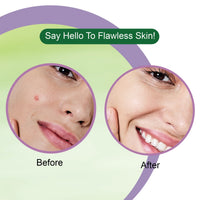 DR.RASHEL Neem Acne Pimple Patch | Natural Spot Treatment for Pimples, Acne & Blemishes (36 Patches)