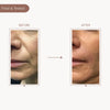 Dromen & Co Lifting & Firming Under Eye And Cheek Strips