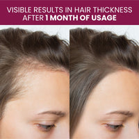 Vlado's Himalayan Organics Biotin 10000Mcg For Healthy Hair And Skin - 60 Tablets