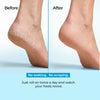 COSTAK Sole Revival 20% Urea Heel Roll-On 50ML