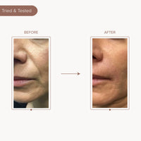Dromen & Co Lifting & Firming Under Eye And Cheek Strips