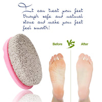 Majestique Pumice Stone With Grip Pedicure Tools Assorted 1 Piece